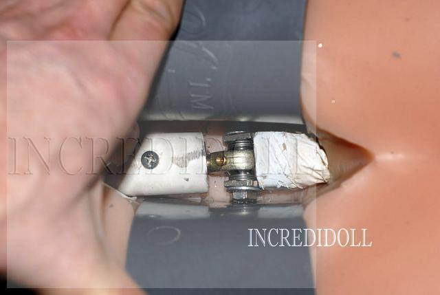 B2 Back repair (21)a