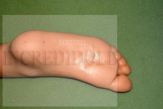 B2 Back repair (30)a