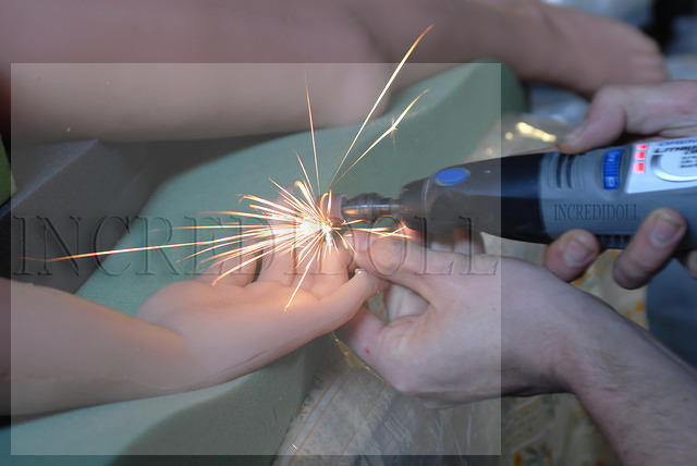 Finger repair (3b)