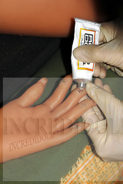Finger repair (8b)