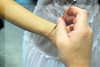 Wrist Repair (36b)