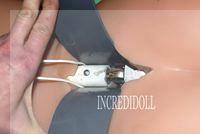 B2 Back repair (20)a