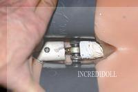 B2 Back repair (21)a