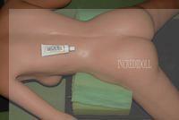 B2 Back repair (28)a