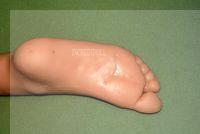 B2 Back repair (30)a